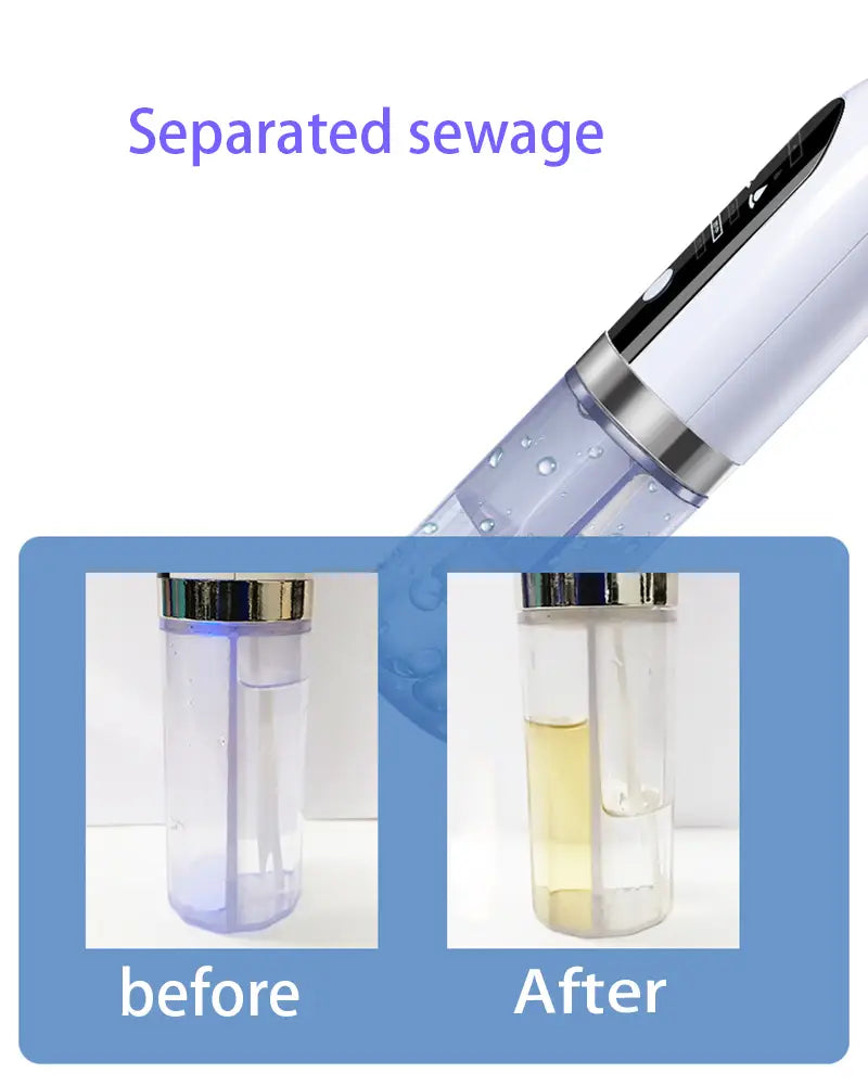 Pore Cleaner with Adjustable Suction and Three Replaceable Probes