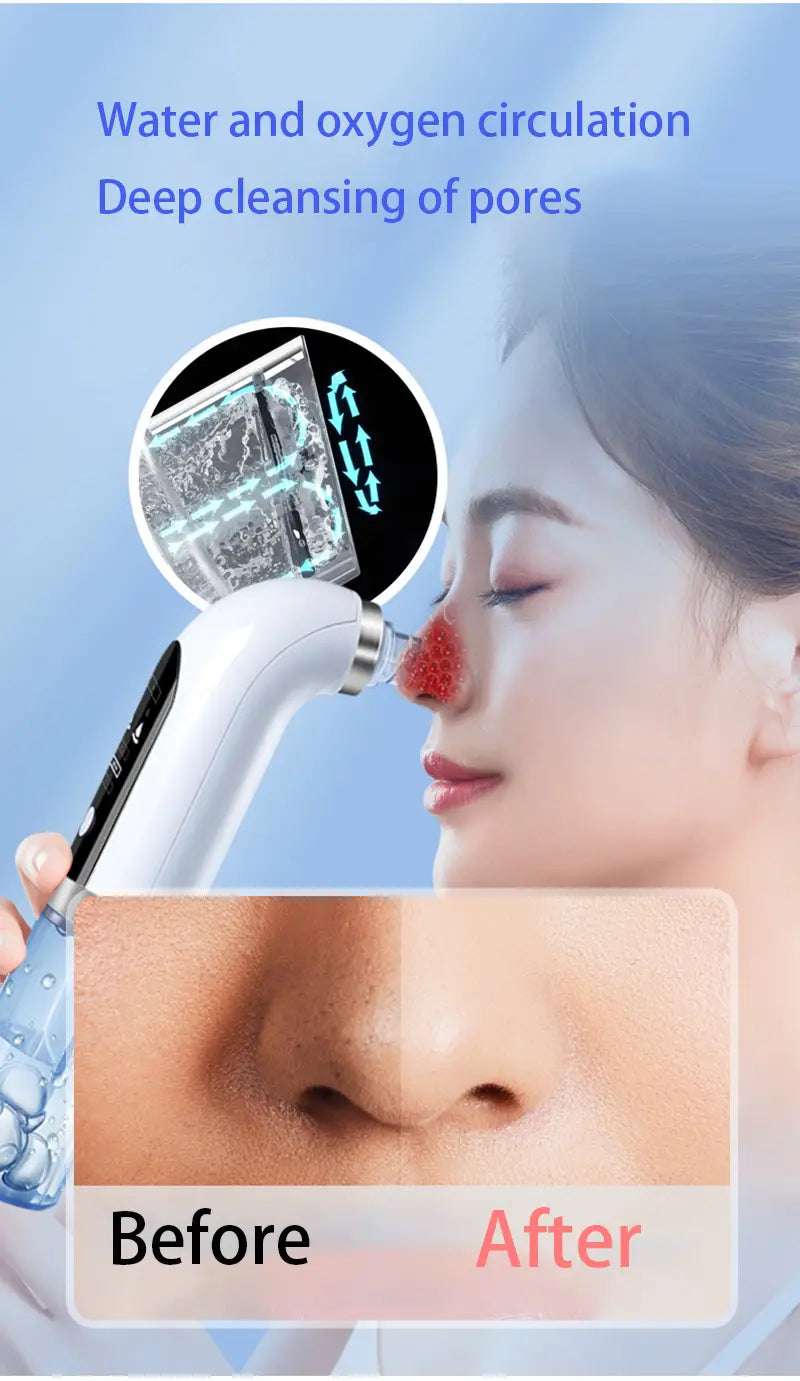 Pore Cleaner with Adjustable Suction and Three Replaceable Probes